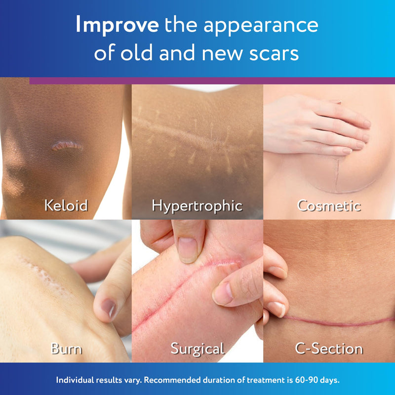 ScarAway Silicone Scar Gel – Improve Size, Color & Texture of Hypertrophic & Keloid Scars (10g)