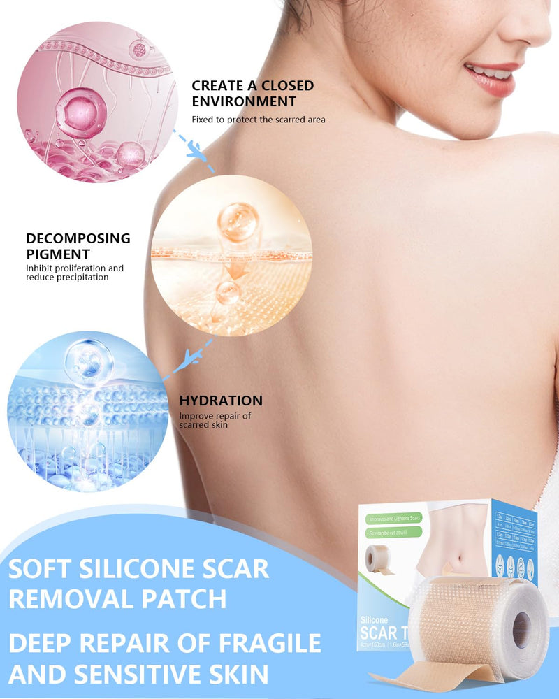 Somlzu Silicone Scar Sheets Tape — 1.6" x 120" Medical-Grade Scar Tape (2 Rolls) for Surgical, C-Section & Burn Scars