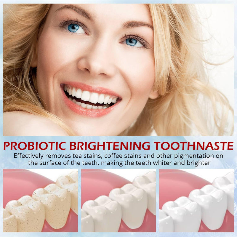 SP-6 Probiotics Whitening Toothpaste – Probiotics for Teeth Whitening & Gum Health