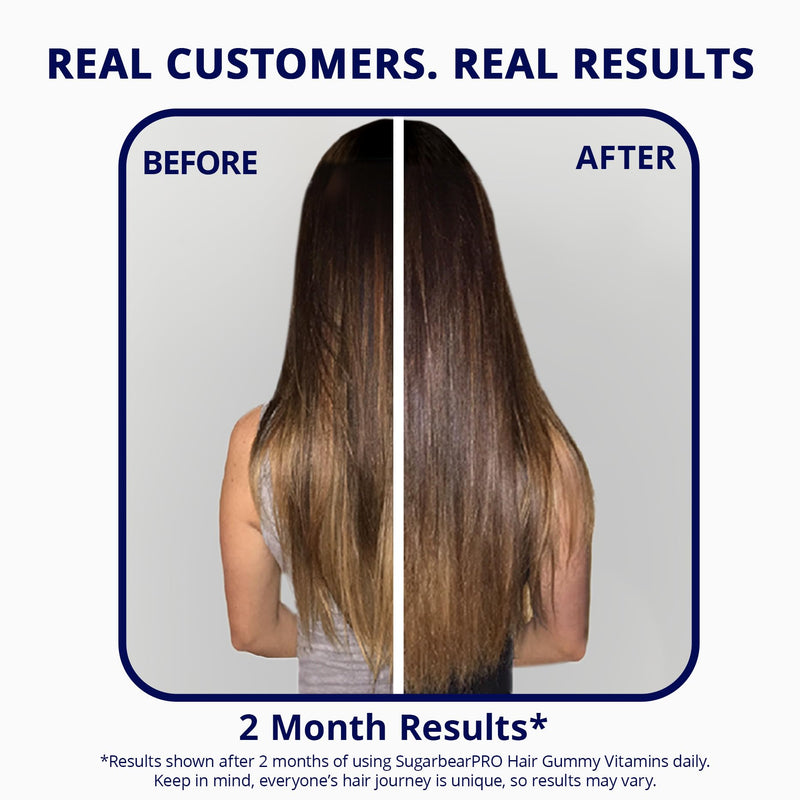 SugarBearHair Growth Gummy - Extra Strength Biotin 6000mcg, 2 Month Supply, Vegan & Cruelty-Free