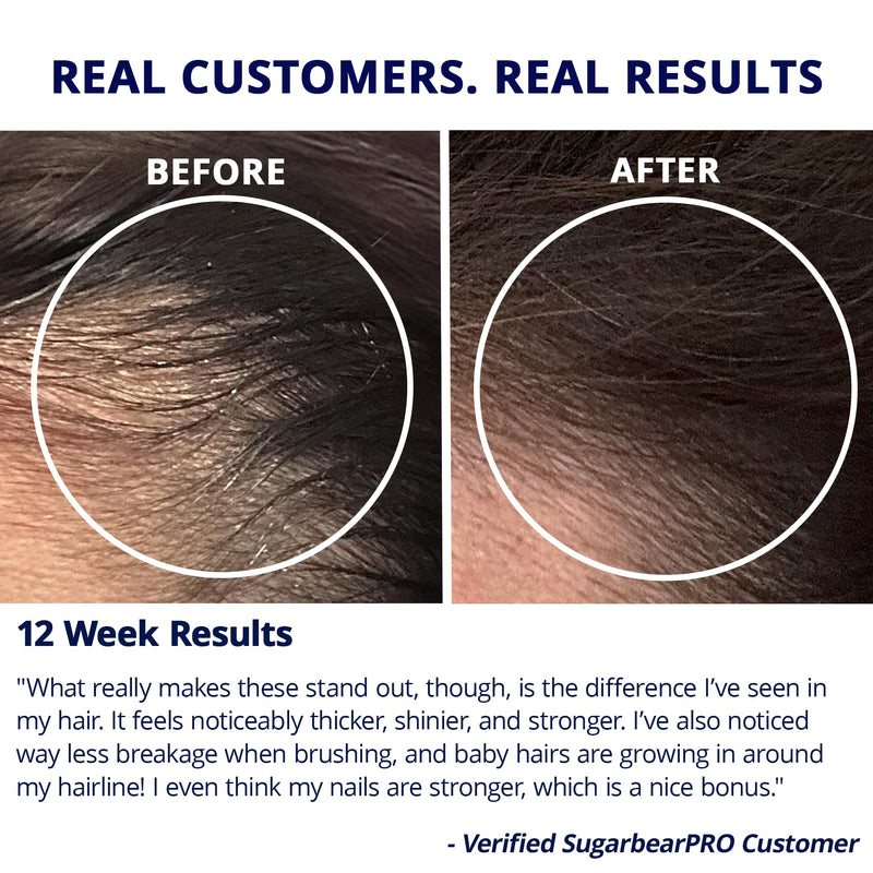 SugarBearPro Hair Vitamin Gummy – Extra Strength Biotin 6000mcg (6-Month Supply) | Vegan, Kosher, Halal, Cruelty-Free