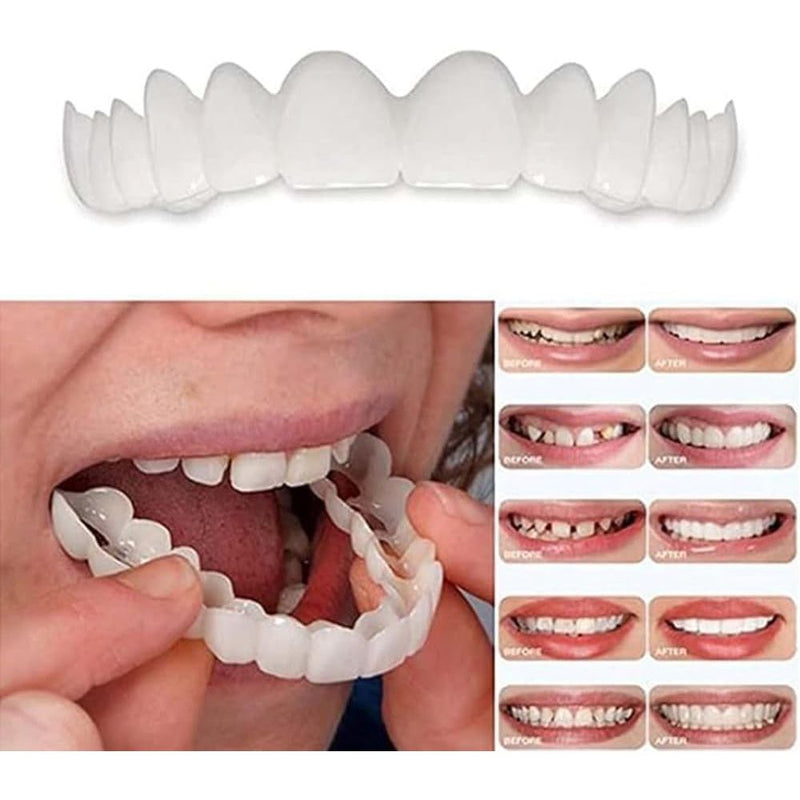 Temporary Smile Solution - 2 Pairs, Adjustable & Comfortable, Restores Confidence for All (1)