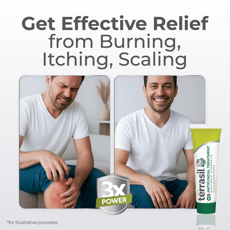 Terrasil Clotrimazole Antifungal Cream – Relief for Fungal Infections (1 oz) | Athlete’s Foot, Jock Itch, Ringworm | FSA/HSA Eligible
