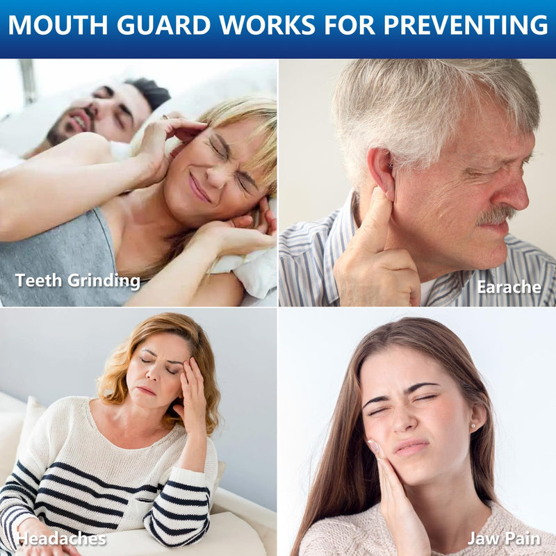 Mouth Guard for Grinding Teeth at Night | Night Guards