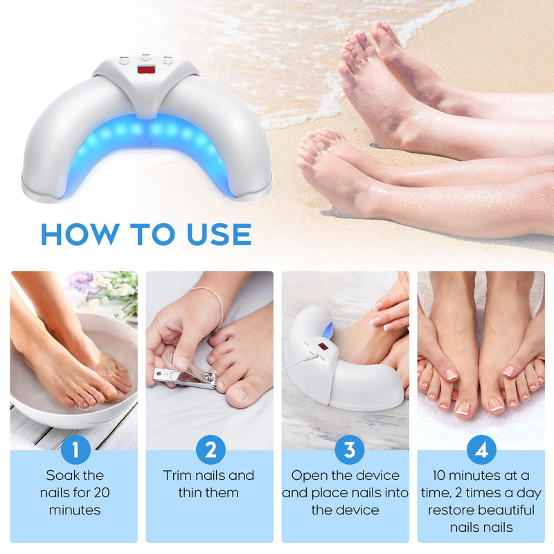 ZZP Toenail Fungus Device – White, Multi-Nail Home Light Therapy